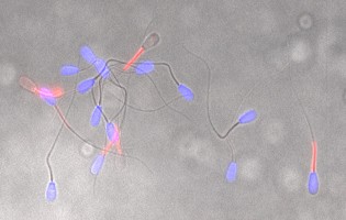Bovine sperm under the fluorescent microscope